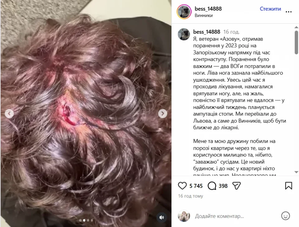 Пораненого ветерана «Азова» у Львові побили після скарг на звук від милиць
